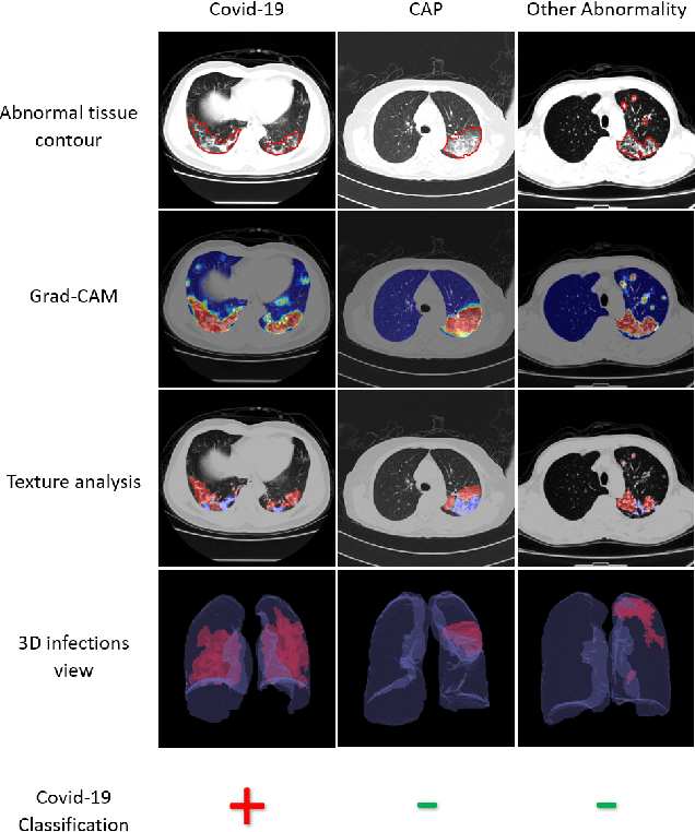 Figure 1 for Automated triage of COVID-19 from various lung abnormalities using chest CT features