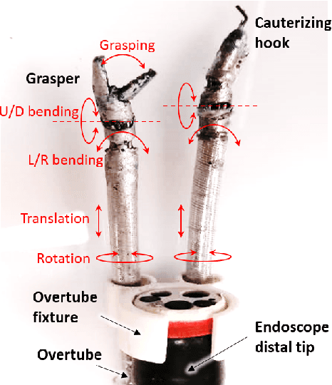 Figure 4 for A Three-limb Teleoperated Robotic System with Foot Control for Flexible Endoscopic Surgery