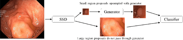 Figure 1 for Detecting small polyps using a Dynamic SSD-GAN