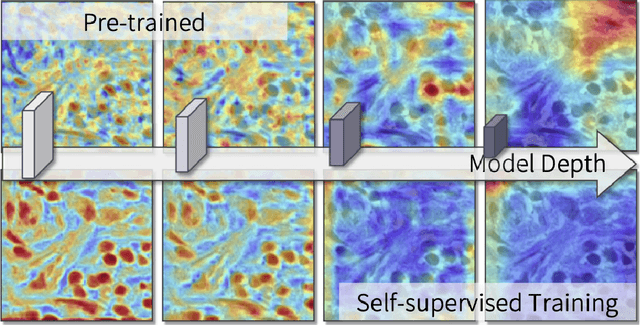 Figure 1 for Unsupervised Dense Nuclei Detection and Segmentation with Prior Self-activation Map For Histology Images