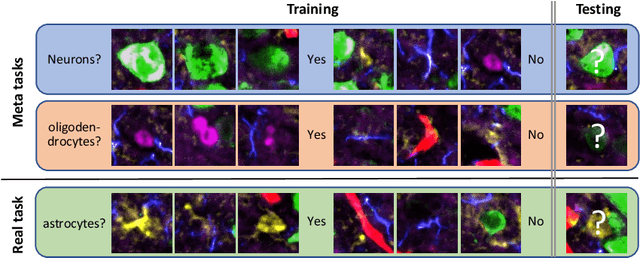 Figure 1 for Few Is Enough: Task-Augmented Active Meta-Learning for Brain Cell Classification