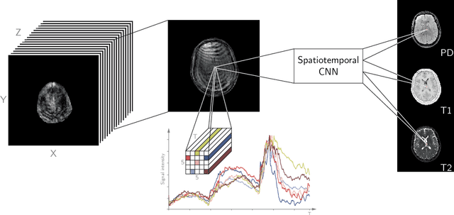Figure 1 for Magnetic Resonance Fingerprinting Reconstruction via Spatiotemporal Convolutional Neural Networks