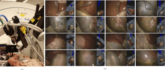 Figure 3 for SERV-CT: A disparity dataset from CT for validation of endoscopic 3D reconstruction