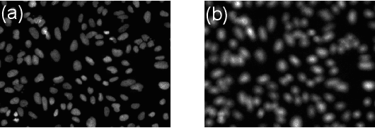 Figure 1 for Adaptive Weighting Depth-variant Deconvolution of Fluorescence Microscopy Images with Convolutional Neural Network