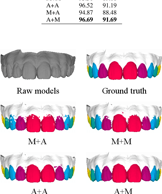 Figure 4 for Two-Stream Graph Convolutional Network for Intra-oral Scanner Image Segmentation