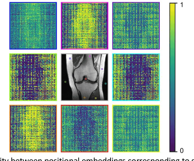 Figure 4 for Multi-head Cascaded Swin Transformers with Attention to k-space Sampling Pattern for Accelerated MRI Reconstruction