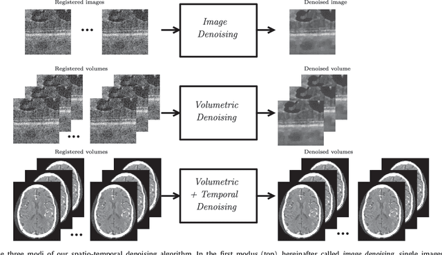Figure 1 for Temporal and Volumetric Denoising via Quantile Sparse Image (QuaSI) Prior in Optical Coherence Tomography and Beyond