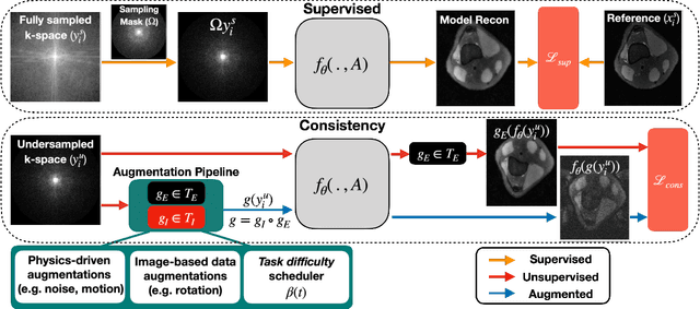 Figure 1 for VORTEX: Physics-Driven Data Augmentations for Consistency Training for Robust Accelerated MRI Reconstruction
