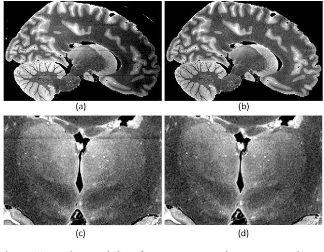 Figure 2 for A probabilistic atlas of the human thalamic nuclei combining ex vivo MRI and histology
