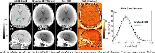 Figure 4 for Using Uncertainty in Deep Learning Reconstruction for Cone-Beam CT of the Brain