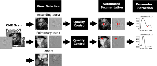 Figure 1 for Automated Quality Controlled Analysis of 2D Phase Contrast Cardiovascular Magnetic Resonance Imaging
