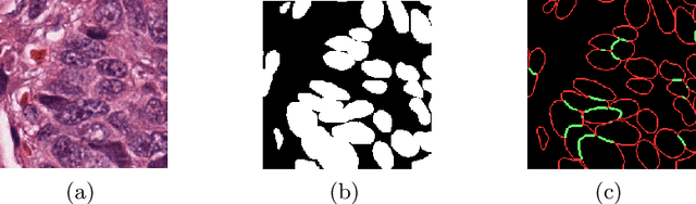 Figure 1 for Boundary-assisted Region Proposal Networks for Nucleus Segmentation