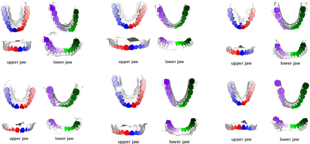 Figure 4 for Teeth3DS: a benchmark for teeth segmentation and labeling from intra-oral 3D scans