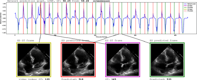 Figure 3 for Ultrasound Video Transformers for Cardiac Ejection Fraction Estimation
