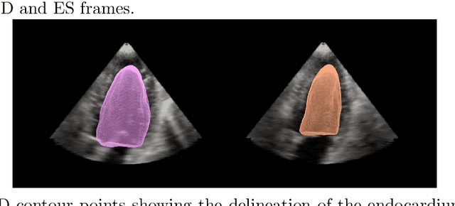 Figure 3 for A New Semi-Automated Algorithm for Volumetric Segmentation of the Left Ventricle in Temporal 3D Echocardiography Sequences