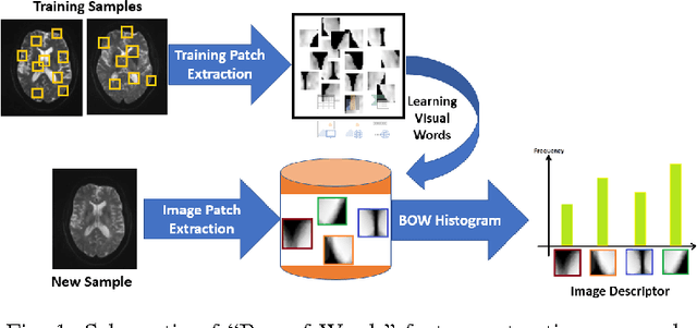 Figure 1 for A Machine Learning Approach For Identifying Patients with Mild Traumatic Brain Injury Using Diffusion MRI Modeling