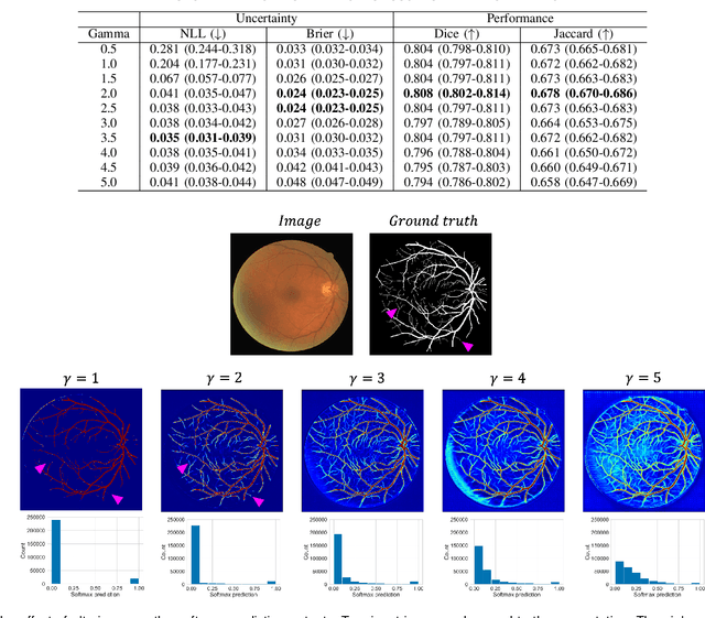 Figure 2 for Calibrating the Dice loss to handle neural network overconfidence for biomedical image segmentation