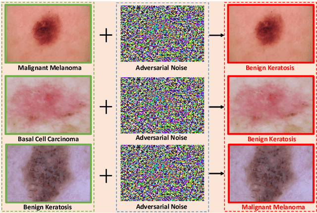 Figure 1 for Fight Fire With Fire: Reversing Skin Adversarial Examples by Multiscale Diffusive and Denoising Aggregation Mechanism