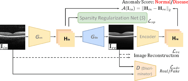 Figure 3 for Sparse-GAN: Sparsity-constrained Generative Adversarial Network for Anomaly Detection in Retinal OCT Image