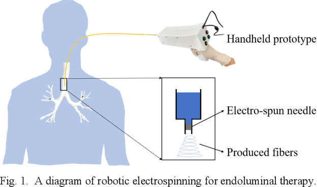 Figure 1 for Robotic Electrospinning Actuated by Non-Circular Joint Continuum Manipulator for Endoluminal Therapy
