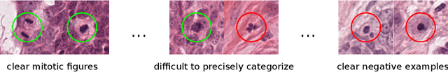 Figure 1 for Dogs as Model for Human Breast Cancer: A Completely Annotated Whole Slide Image Dataset