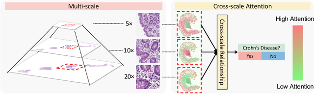 Figure 1 for Cross-scale Attention Guided Multi-instance Learning for Crohn's Disease Diagnosis with Pathological Images