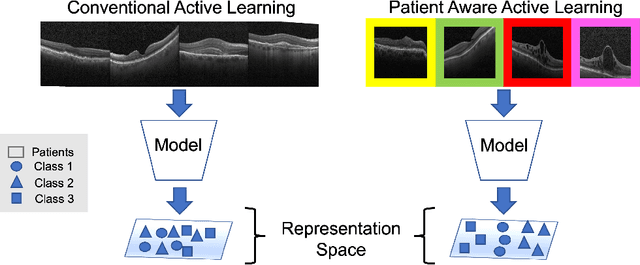 Figure 3 for Patient Aware Active Learning for Fine-Grained OCT Classification