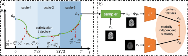 Figure 1 for Multi-scale Neural ODEs for 3D Medical Image Registration
