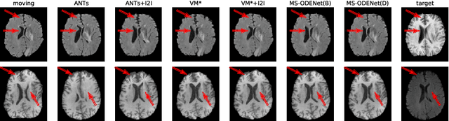 Figure 4 for Multi-scale Neural ODEs for 3D Medical Image Registration