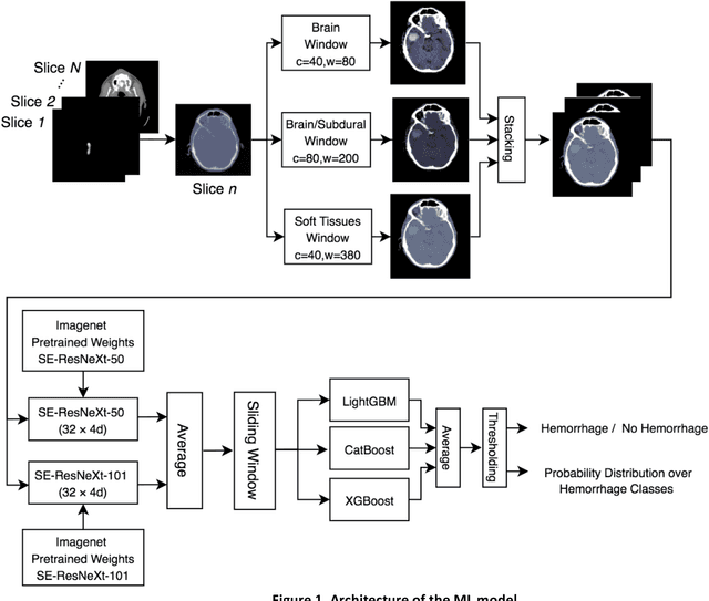 Figure 2 for A Real-World Demonstration of Machine Learning Generalizability: Intracranial Hemorrhage Detection on Head CT
