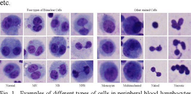 Figure 1 for From WSI-level to Patch-level: Structure Prior Guided Binuclear Cell Fine-grained Detection