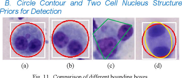Figure 2 for From WSI-level to Patch-level: Structure Prior Guided Binuclear Cell Fine-grained Detection