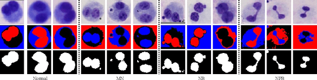 Figure 4 for From WSI-level to Patch-level: Structure Prior Guided Binuclear Cell Fine-grained Detection