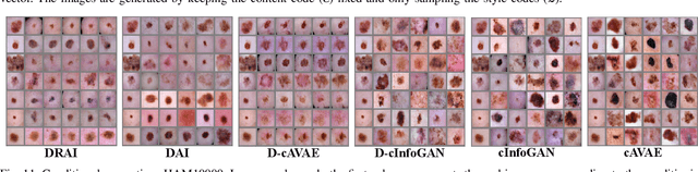 Figure 3 for Conditional Generation of Medical Images via Disentangled Adversarial Inference