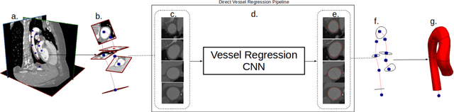 Figure 1 for Geometric Uncertainty in Patient-Specific Cardiovascular Modeling with Convolutional Dropout Networks