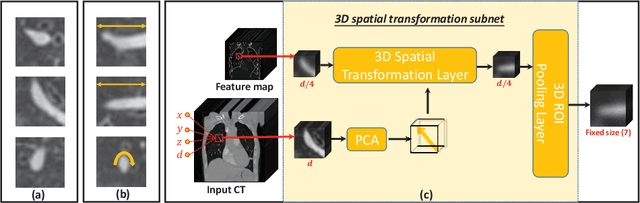 Figure 3 for Automated Pulmonary Embolism Detection from CTPA Images Using an End-to-End Convolutional Neural Network
