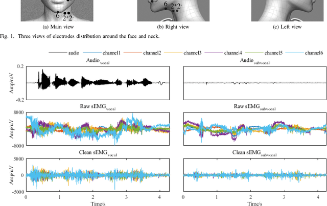 Figure 4 for Voice Reconstruction from Silent Speech with a Sequence-to-Sequence Model