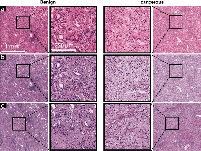 Figure 4 for A generative adversarial approach to facilitate archival-quality histopathologic diagnoses from frozen tissue sections
