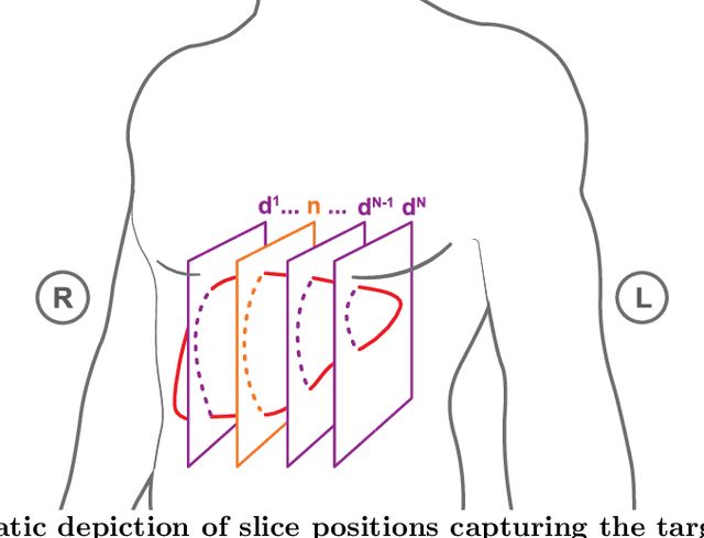 Figure 4 for 4D MRI: Robust sorting of free breathing MRI slices for use in interventional settings