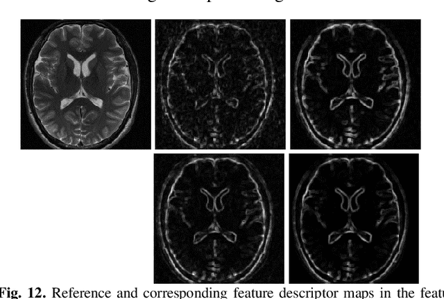 Figure 4 for IFR-Net: Iterative Feature Refinement Network for Compressed Sensing MRI