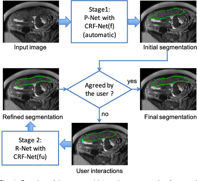 Figure 1 for DeepIGeoS: A Deep Interactive Geodesic Framework for Medical Image Segmentation