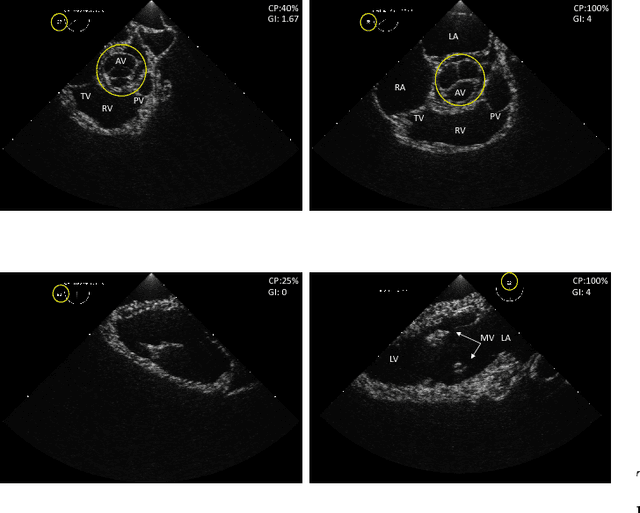 Figure 1 for Automated Performance Assessment in Transoesophageal Echocardiography with Convolutional Neural Networks