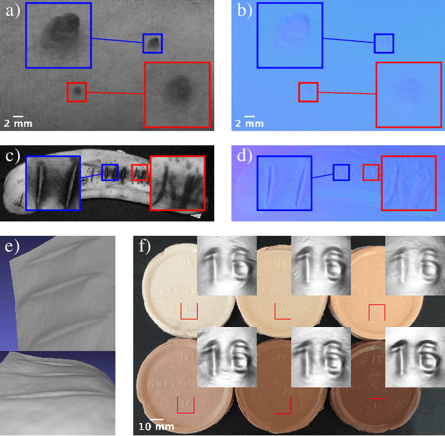 Figure 4 for SkinScan: Low-Cost 3D-Scanning for Dermatologic Diagnosis and Documentation