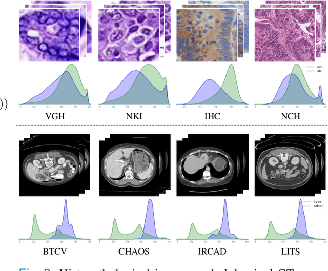 Figure 4 for Domain Generalization on Medical Imaging Classification using Episodic Training with Task Augmentation