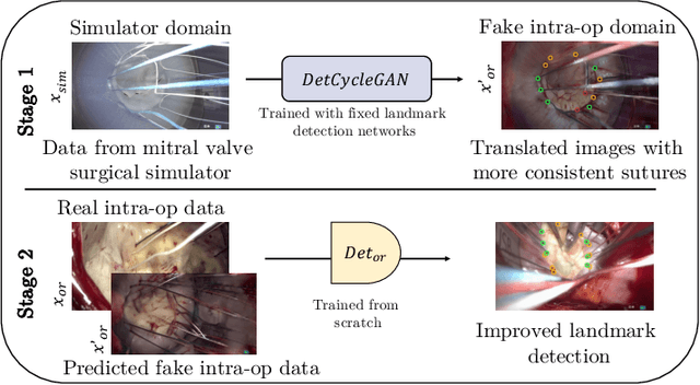 Figure 1 for Mutually improved endoscopic image synthesis and landmark detection in unpaired image-to-image translation