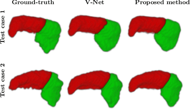 Figure 4 for Dilated deeply supervised networks for hippocampus segmentation in MRI