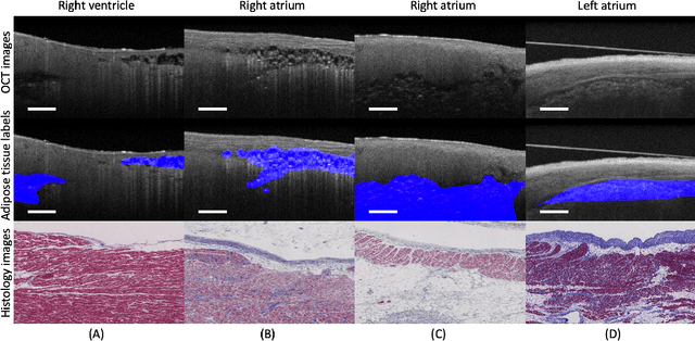 Figure 1 for Cardiac Adipose Tissue Segmentation via Image-Level Annotations