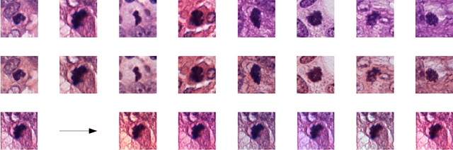 Figure 1 for Domain-adversarial neural networks to address the appearance variability of histopathology images