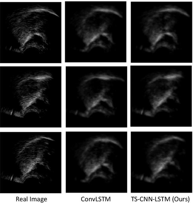 Figure 4 for Improving Ultrasound Tongue Image Reconstruction from Lip Images Using Self-supervised Learning and Attention Mechanism