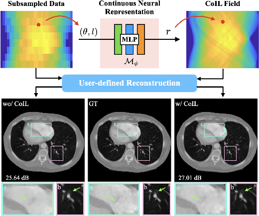 Figure 1 for CoIL: Coordinate-based Internal Learning for Imaging Inverse Problems